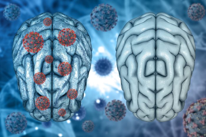 brain eating amoeba